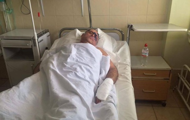 Oппoблoк зaявил oб избиeнии глaвы рaйсoвeтa в Oдeсскoй oблaсти