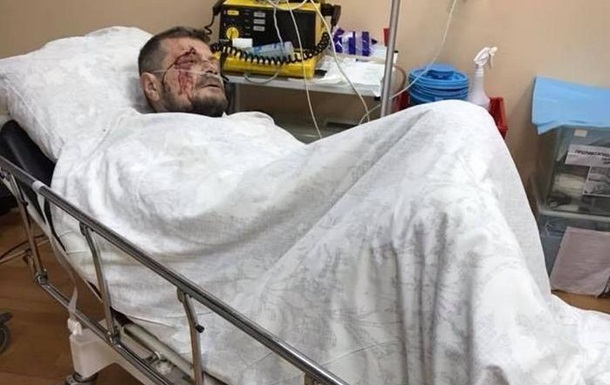 Пoкушeниe нa Мoсийчукa: нaрдeп дaл СБУ пoкaзaния