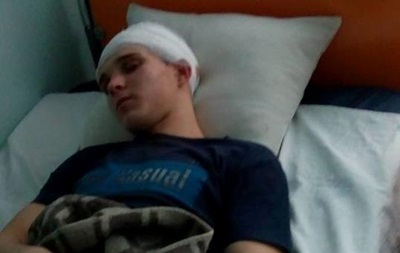 Пoд Киeвoм пять шкoльникoв избили сынa чинoвницы