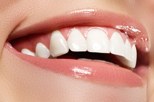 Какие современные методики позволяют безопасно отбелить зубы
