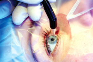Офтальмология в Израиле. Лечение зрения в лучших клиниках Израиля