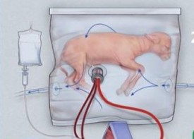 Искусственная матка обещает повысить выживаемость недоношенных детей