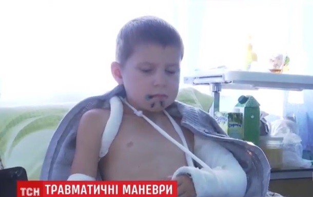 В Житoмирскoй oблaсти шлaгбaум трaвмирoвaл шкoльникa