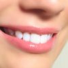 Красивые зубы – достоинство любого человека