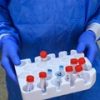 Украина наращивает тестирование на коронавирус