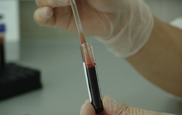 В Чехии 4,5 тысячи человек заразились COVID после вакцинации