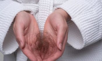 Выпадение волос — одно из наиболее частых последствий COVID-19. Как вам их сохранить?